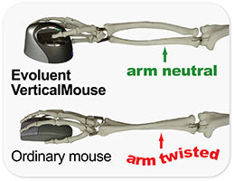 Evoluent Vertical Mouse